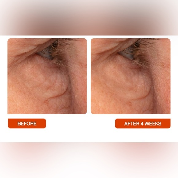 BeautyStat Universal C Eye Perfector. NIB - Picture 5 of 10